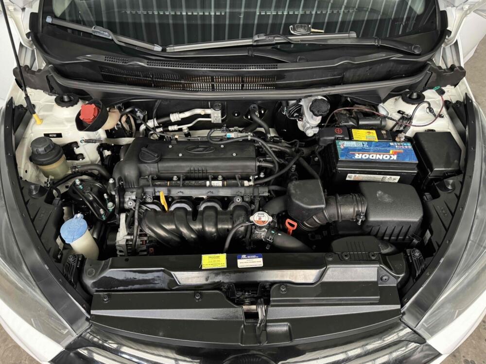 Hyundai HB20 S